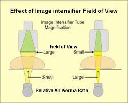 Fluoroscopy