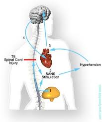 Spinal Cord Injury &amp;  Autonomic 