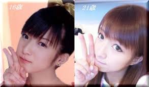 辻希美に整形疑惑…