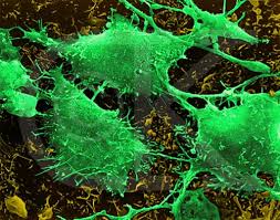 Cancer_cell, brain.jpg