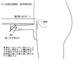 ペニスがやわらかい状態で亀頭を