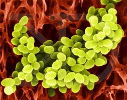 MRSA - Methicillin Resistant - via Daymix