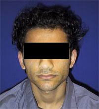 و ضددین آویزون، بیا کلیپ و