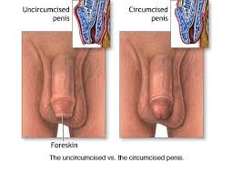Male  Circumcision 