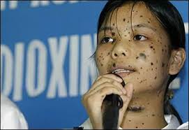      who suffers from  Agent Orange      