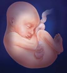 26 Weeks
