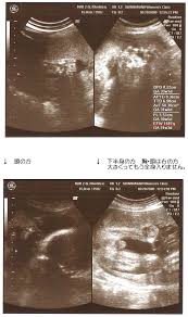 胎児ちゃんの発育記録 2009年