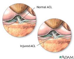  Anterior cruciate ligament 