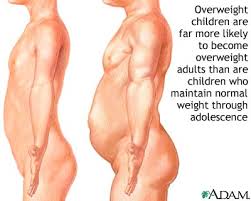 Childhood obesity - via Daymix