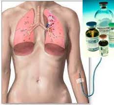 Side-effect-free chemotherapy - via Daymix