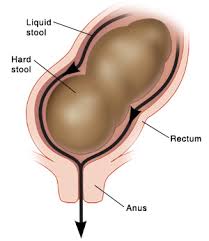out of your child's anus.
