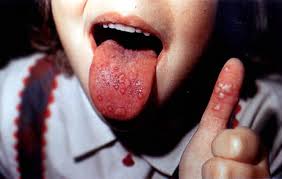 Mouth and thumb