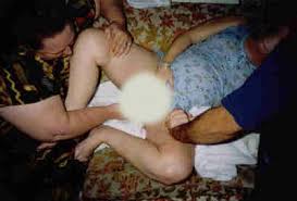 Baby x26s head crowning with  amniotic      