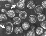 http://www.mirrorservice.org/sites/www.virology.net/Big_Virology/EM/hbvcore3.GIF