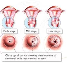 HPV Cells