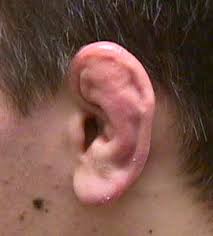 for  perichondritis  and ear