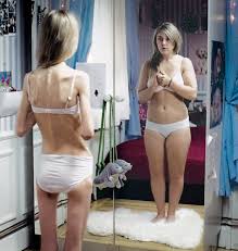 Kim (an anorexic)