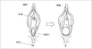 膣を広げたい