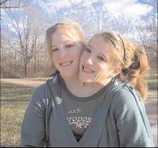 Minnesota x26s  Abby   and  Brittany Hensel      