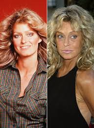 Celebrity Plastic Surgery - via Daymix