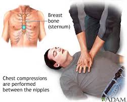  CPR  -  adult  - series