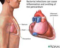 The bacterial infection causes