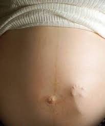 Pregnancy Symptoms, - via Daymix