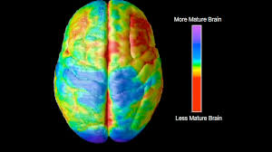 and schizophrenic children - via Daymix