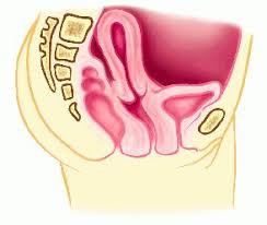  Retroversion  of  uterus .