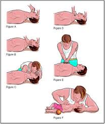 CPR - via Daymix