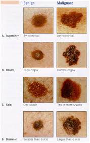 May is  Skin Cancer  Detection