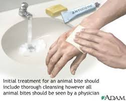  Animal bites 