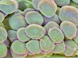 Adipocyte is enlarged in obese - via Daymix