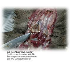  diseases 