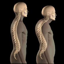 Osteoporosis affects - via Daymix