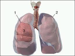 http://www.dehlvi.com/dynamic-images/diseases/Pleurisy279.bmp