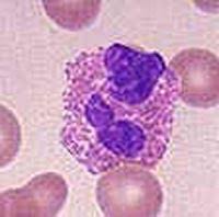 Eosinophilic Enteropathy