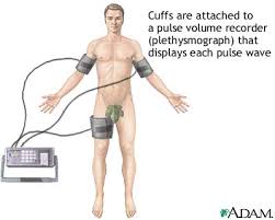 Plethysmography 