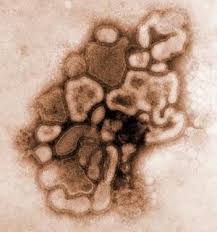 H1N1 - via Daymix