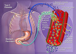 http://www.piuravirtual.com/noticias/img/post/diabetes_type2.jpg