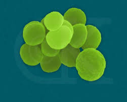  Gonorrhea 
