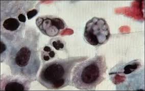 Chlamydia - MicrobeWiki - via Daymix