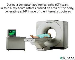  CT scans  are very detailed and