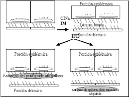 http://www.uv.es/derma/CLindex/CLampollosas/CLampo4.gif