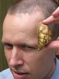 Larson  Tumor  Model.jpg