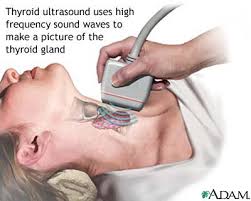  Thyroid  ultrasound