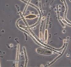   Archaebacteria  
