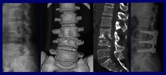 A Lateral  graphy  