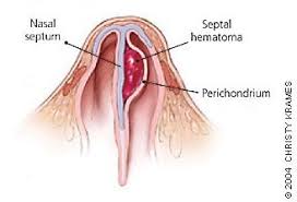 The  septal  cartilage is