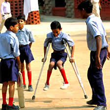  Poliomyelitis  or